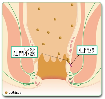 あな痔